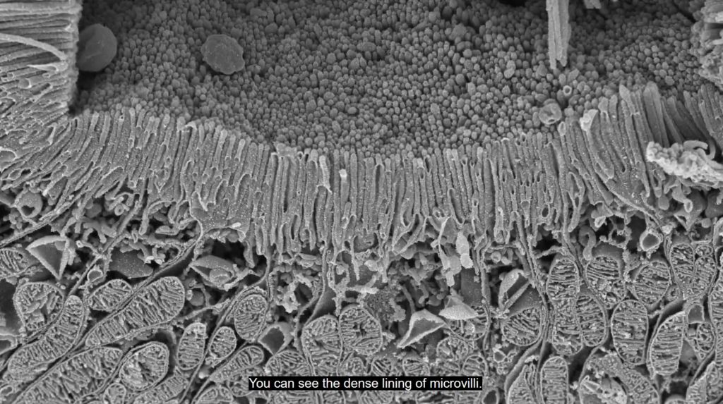 you can see the dense lining of microvilli